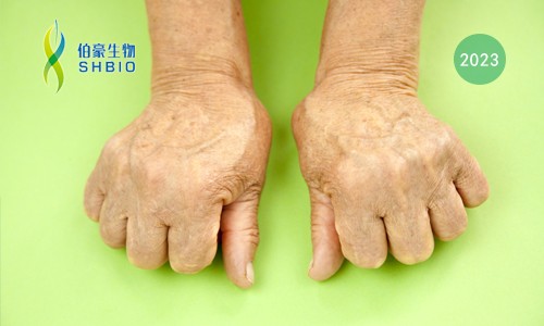 高分文獻一作分享會 | 時空組學技術助力發現類風濕關節炎疾病治療新靶點